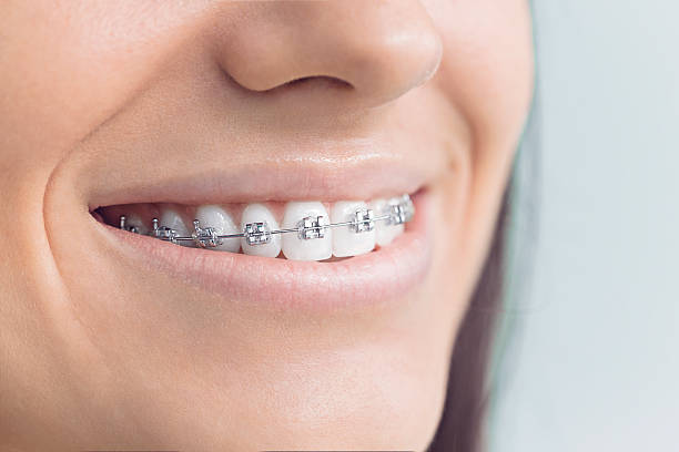 Best Invisalign and Clear Aligners  in La Pine, OR